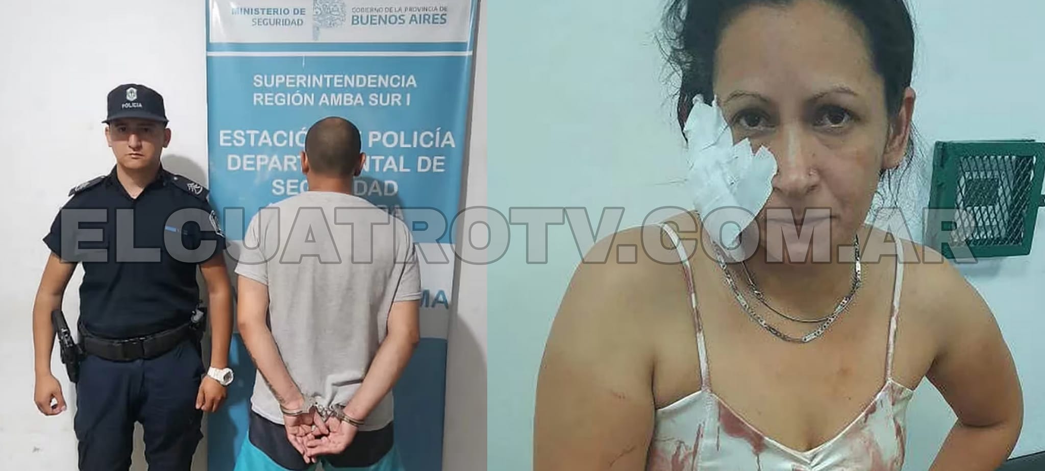 Detenido en Ezeiza tras desfigurar a su pareja en un acto de violencia de género