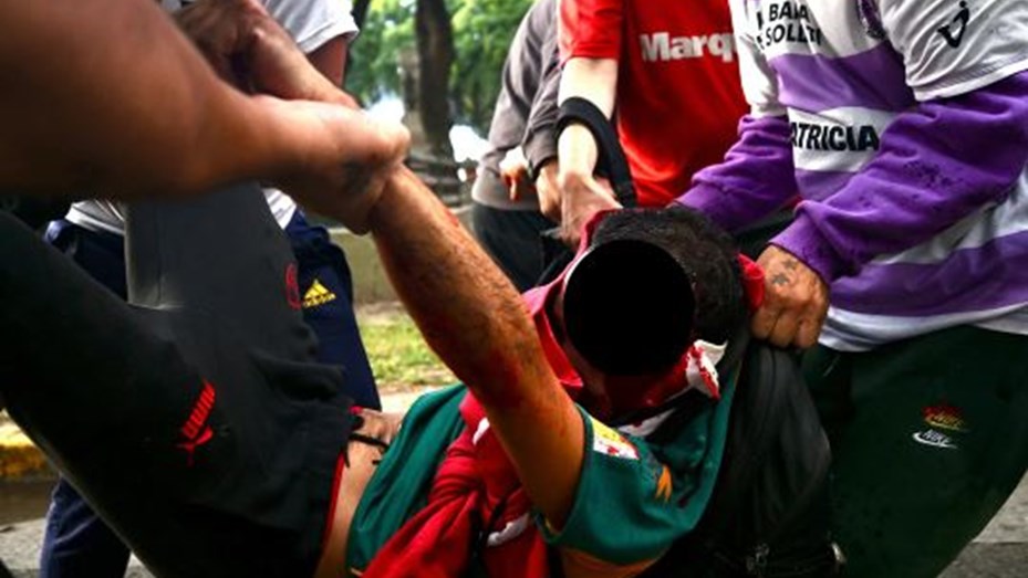 Piden dadores de sangre para el fotógrafo atacado por policías en la marcha de jubilados